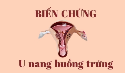 Cảnh báo biến chứng u nang buồng trứng