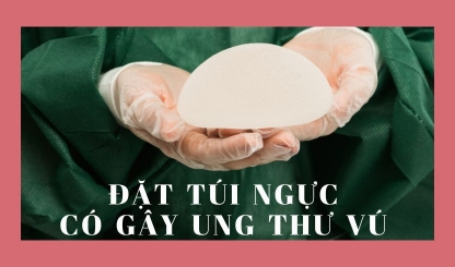 Đặt túi ngực có gây ung thư vú