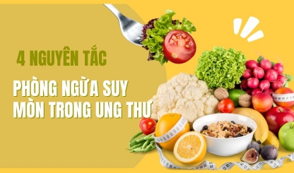 4 nguyên tắc phòng ngừa suy mòn trong ung thư