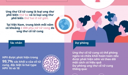 Infographic: Tác nhân, dự phòng và điều trị Ung thư Cổ tử cung