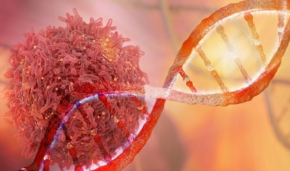 Yếu tố di truyền: Ung thư vú có tính di truyền không? Nếu có người nhà ung thư vú thì nên làm thế nào?