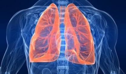 Cảnh báo: 12 dấu hiệu ung thư phổi